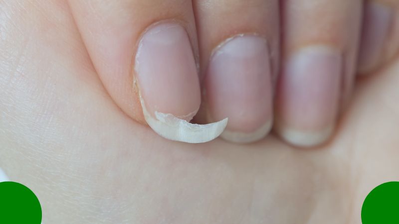 do fingernails decompose blog cover